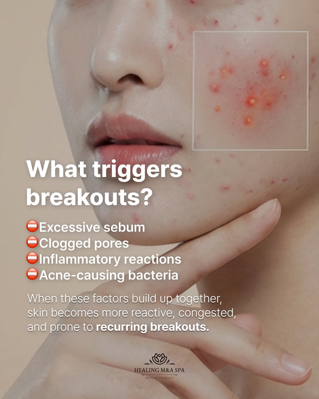 Skin treatment session